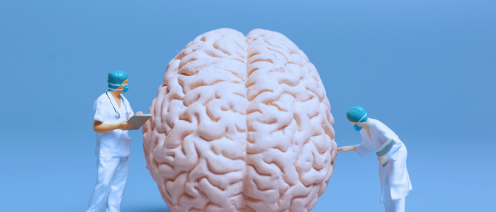 blog Aug 25 fixing the brain 700x300